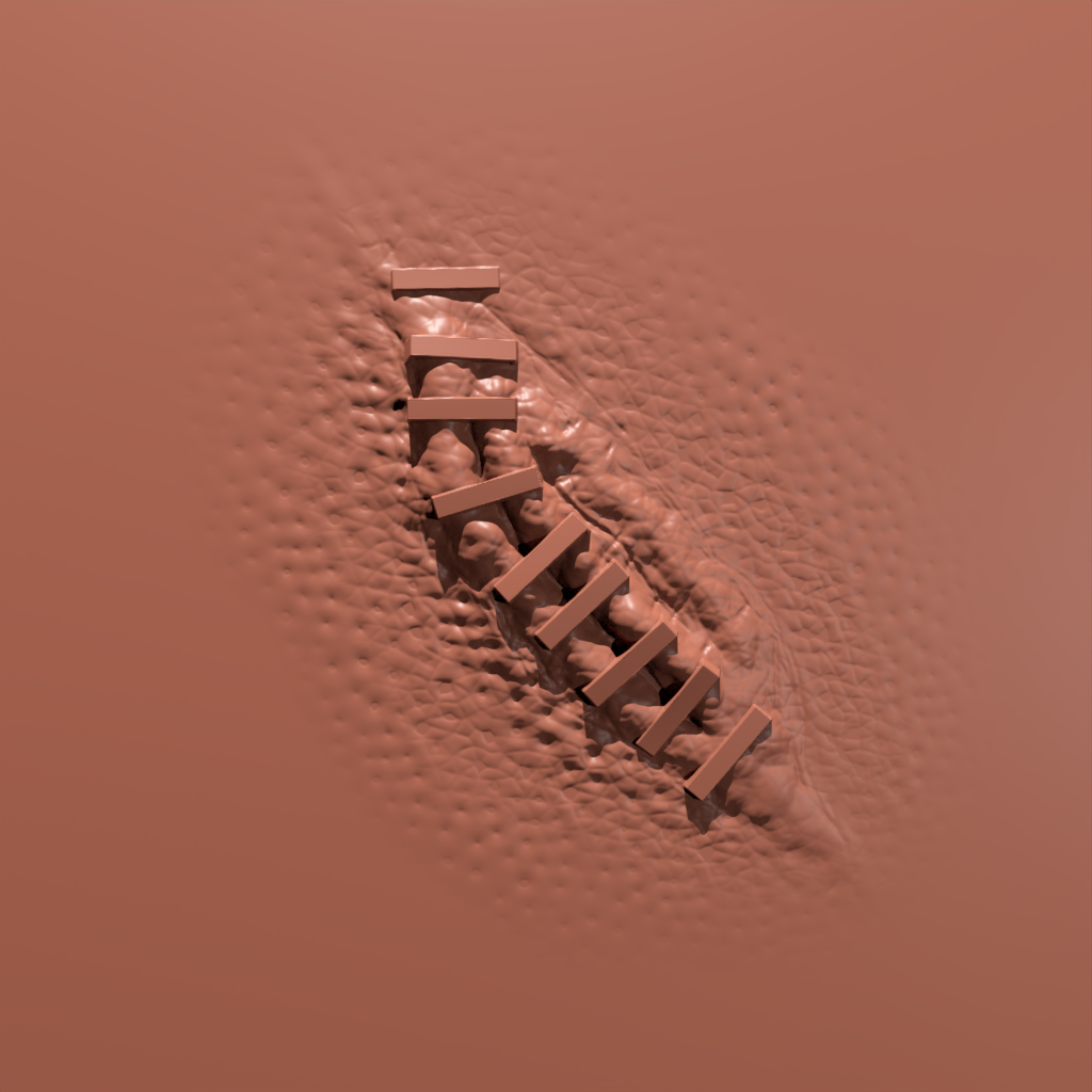 Scar with Staples | FREE 3D human brushes | BlenderKit