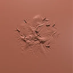 Scar with Stitches and Staples