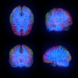 Brain Data Flow