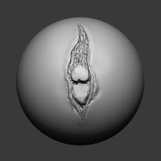 NS Open wound bone