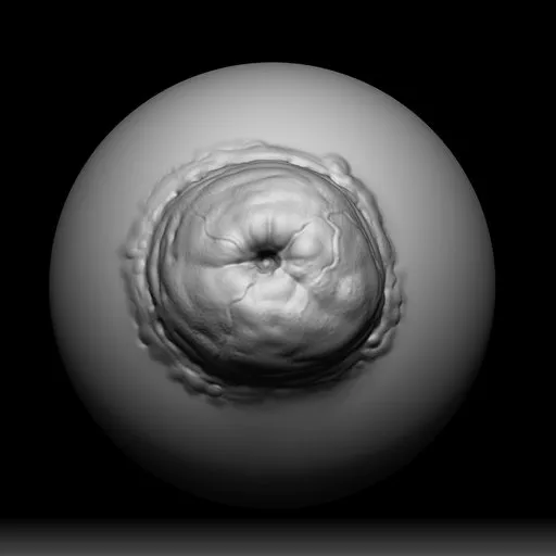 NS Mutant Growth pimple